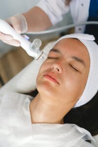 laser treatment for dark circles