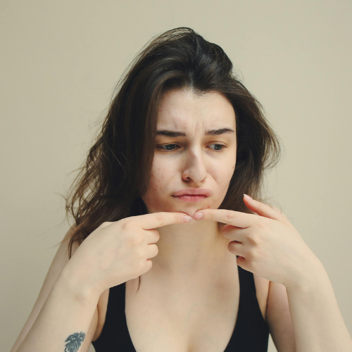 Treat large pores 