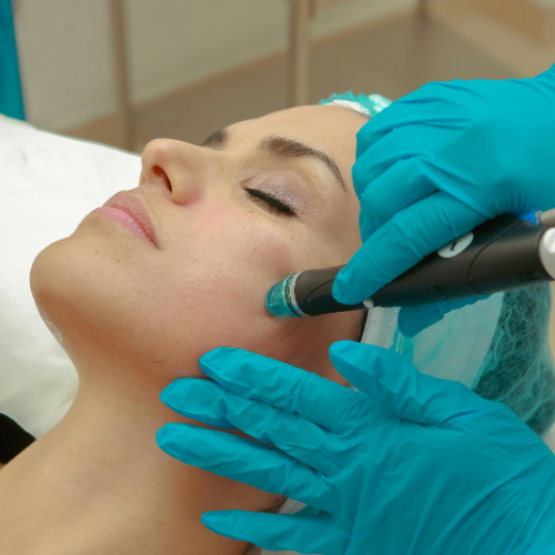 Laser Treatment