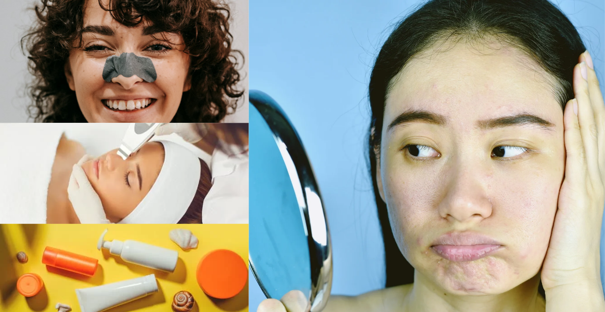 Treat your pores effectively with the available treatments